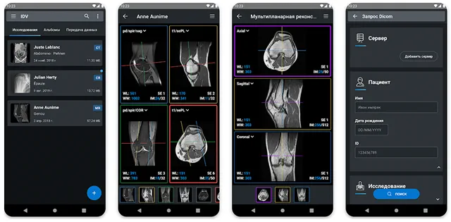 Использование приложения IMAIOS DICOM Viewer для просмотра рентгеновских снимков